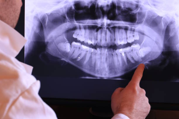 Best Tooth Pain Emergency Relief  in Chackbay, LA